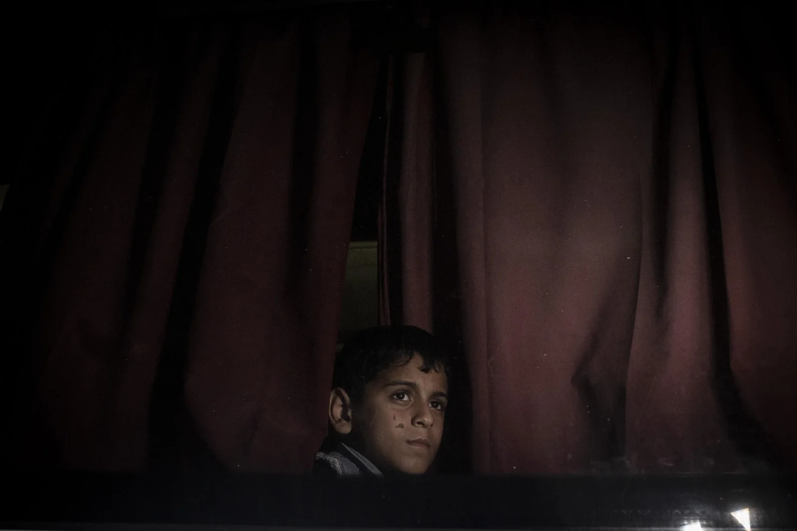 Scars from Gaza, frame 4 of 15