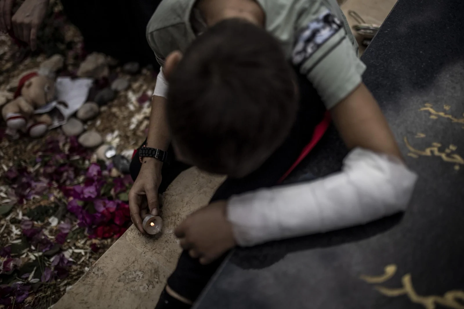 Hoessein (9)with visible physical injuries on his body