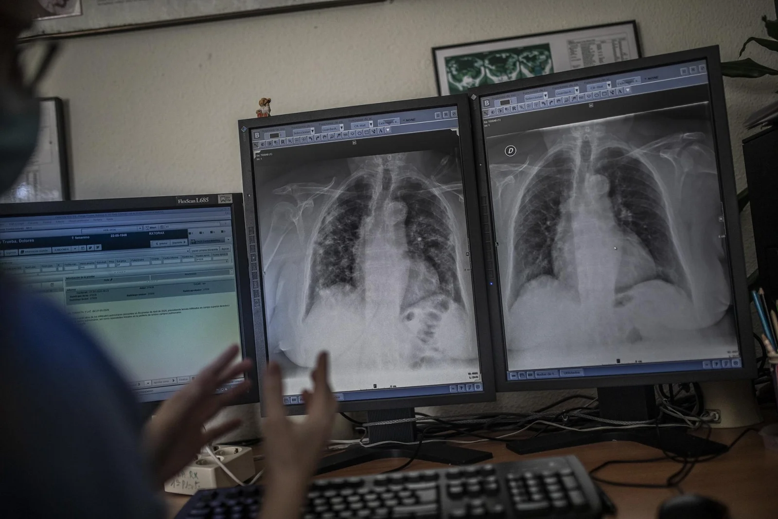 Una trabajadora del departamento de rayos del hospital de La Princesa muestra unas radiografías de una persona contagiada por el COVID-19
